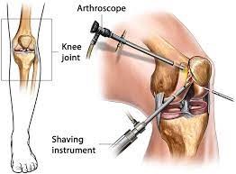 arthroscopy.jpg